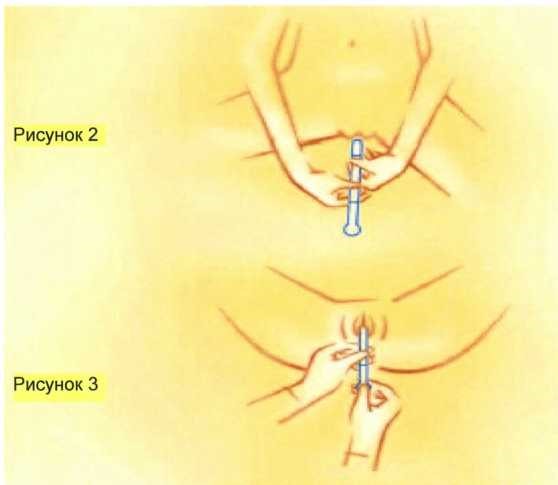 Гинофорт инструкция по применению от молочницы у женщин thumbnail
