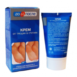 До и после крем от трещин в ступнях