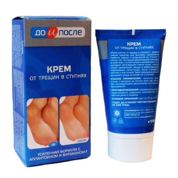 До и после крем от трещин в ступнях