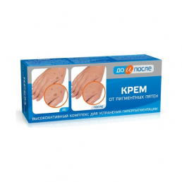 До и после крем от пигментных пятен