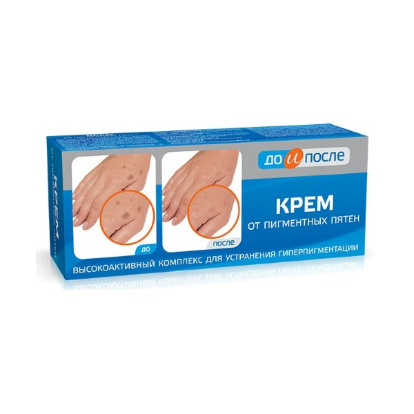 До и после крем от пигментных пятен
